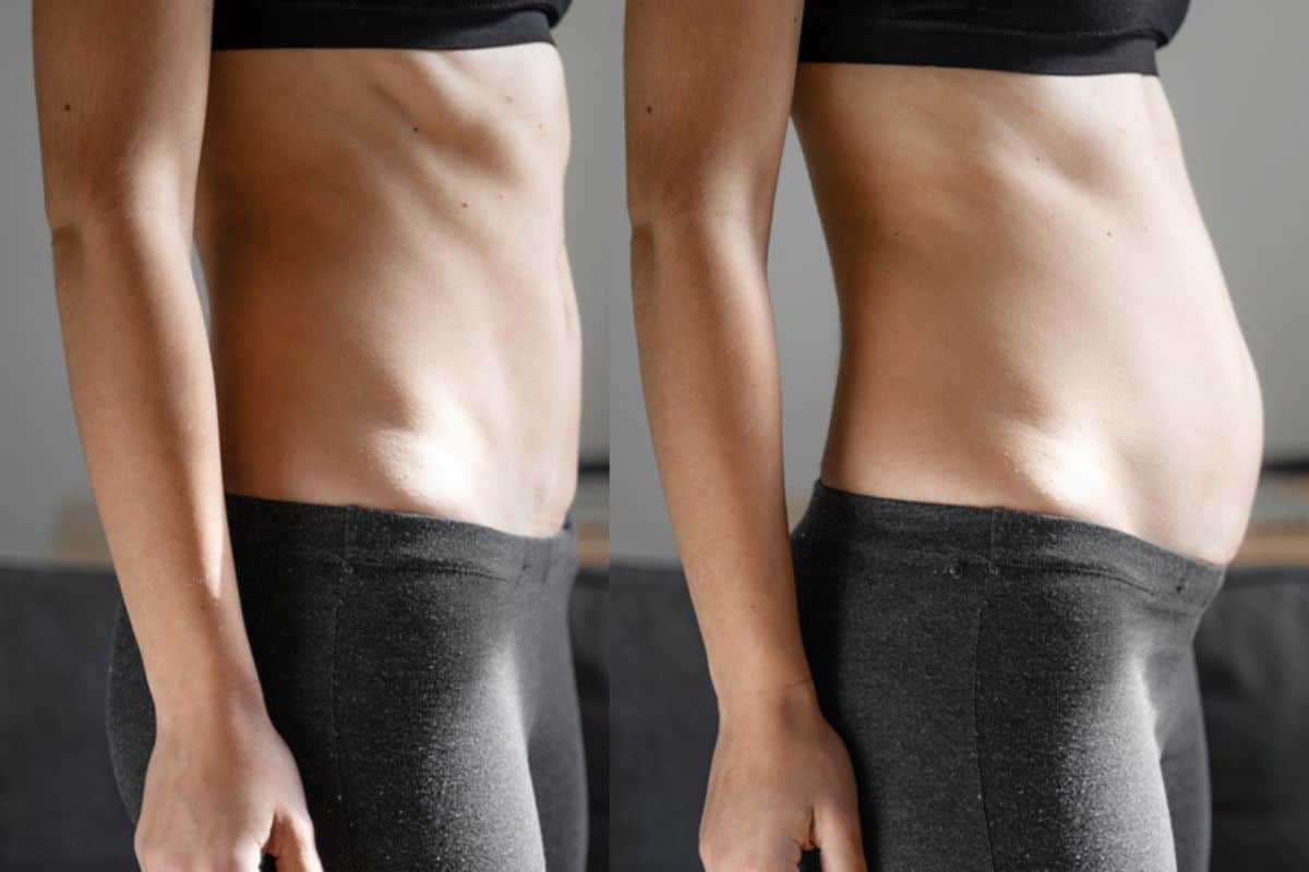 How long does diastasis recti take to improve Reading?