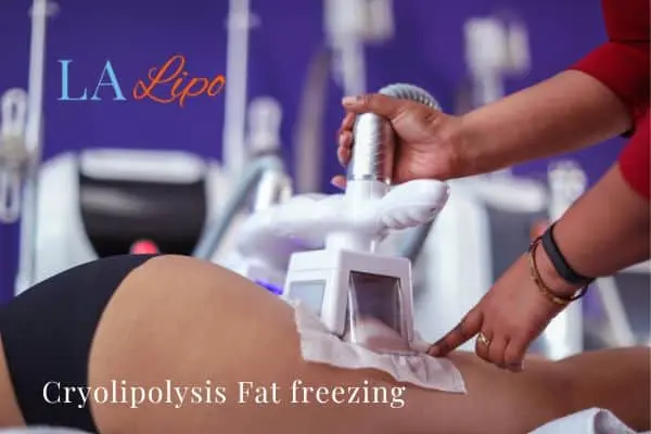 women getting fat freezing Reading