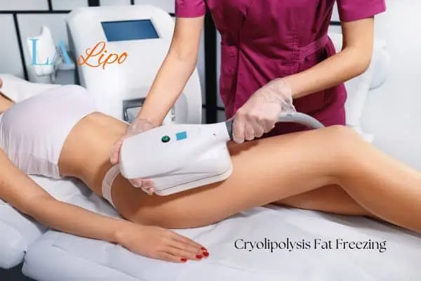 Woman receiving coolsculpting Reading treatment on her thighs