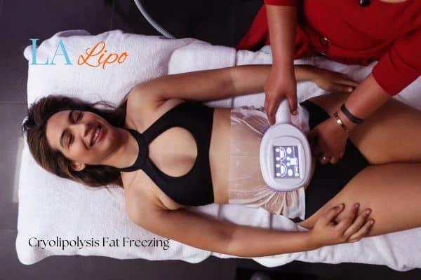 woman getting cryolipolysis Reading
