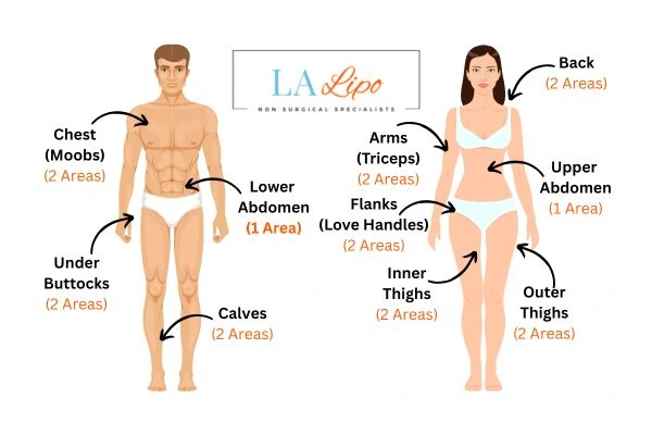 LA LIPO Cryolipolysis Areas Reading