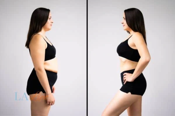Picture of womans before and after using LA-EMS body sculpting to improve her core strength Reading