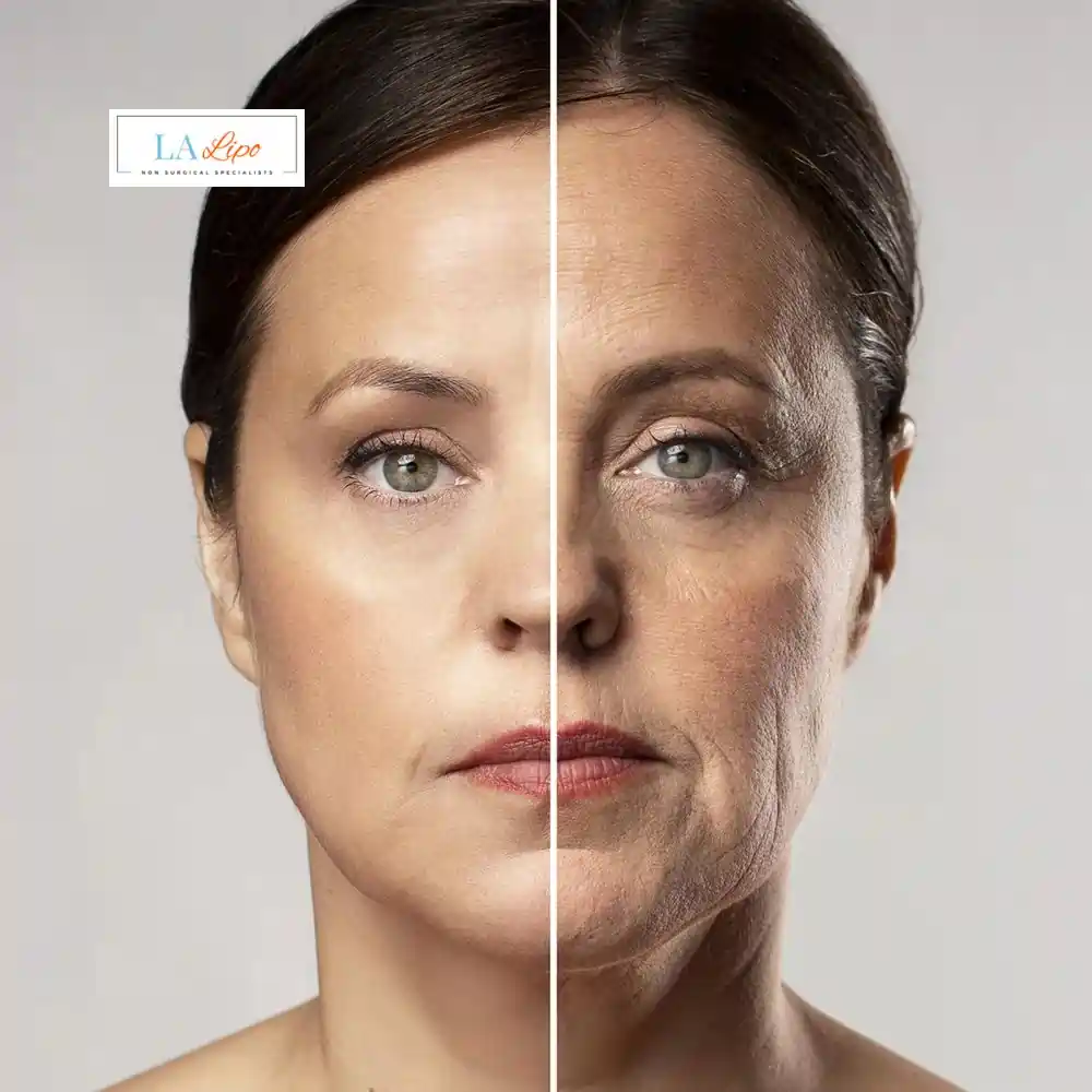 How Can You Tell If Non-Surgical Skin Tightening Is Right for You Reading?