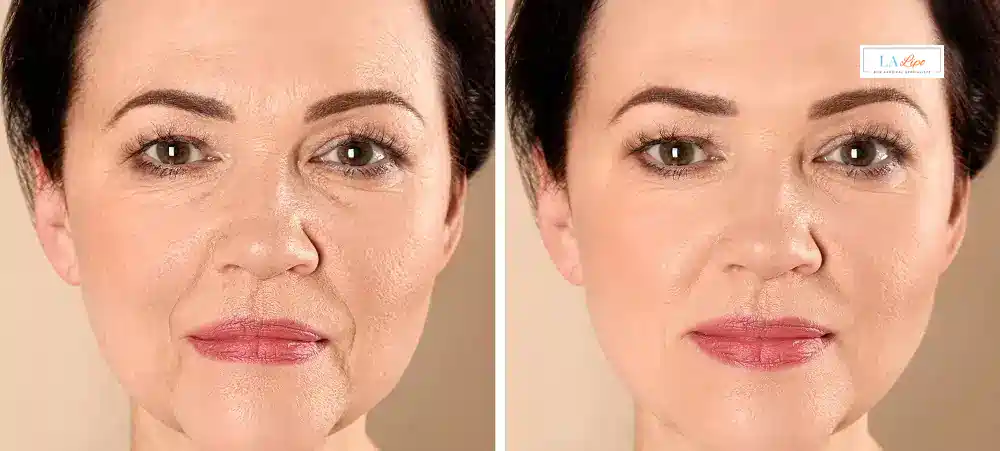 How Long Does It Take to See Results and How Long Do They Last Reading?