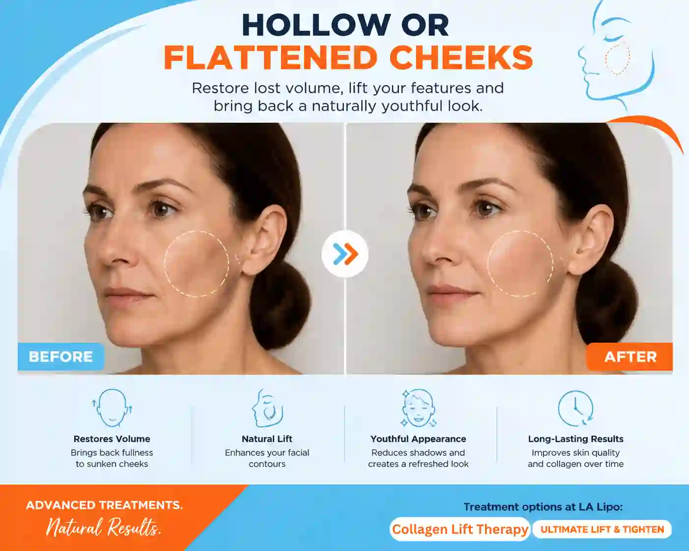 Sign #4: Hollow or Flattened Cheeks Reading