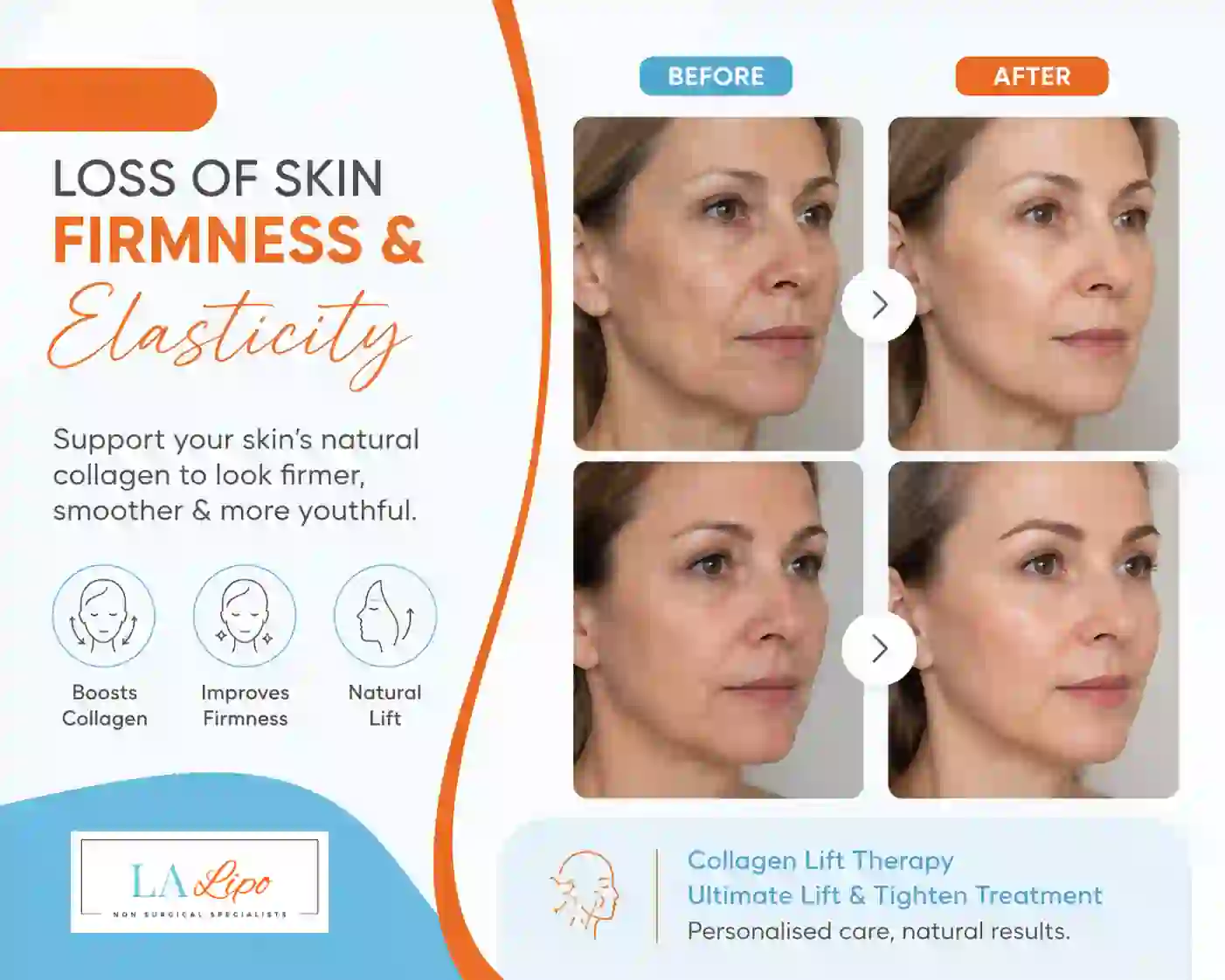 Sign #7: Loss of Skin Firmness and Elasticity Reading