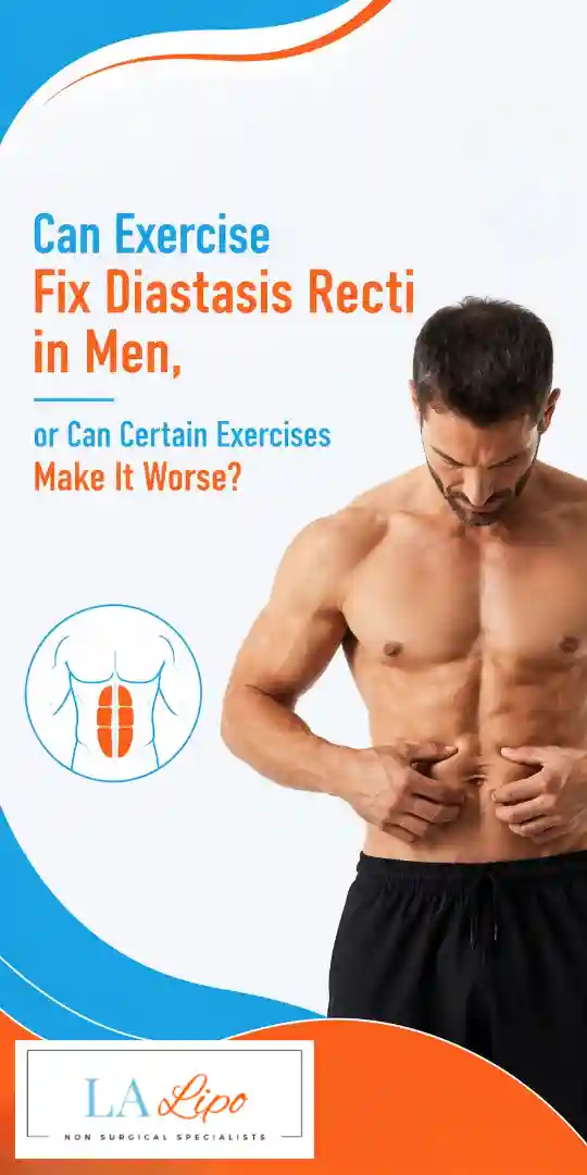 Can Exercise Fix Diastasis Recti in Men, or Can Certain Exercises Make It Worse Reading?